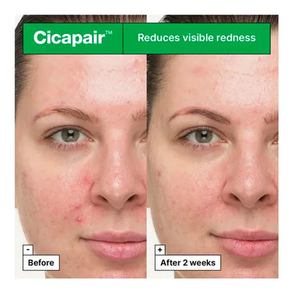 Dr. Jart+ - Cicapair So Soothing Treatment