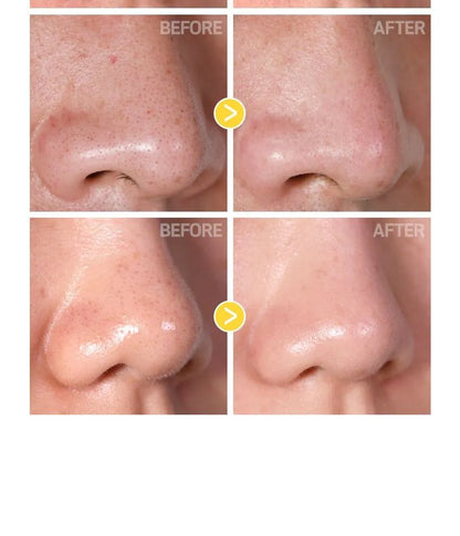 TIA'M - Blackhead Out Sheet